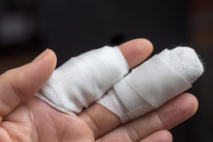 finger injury compensation claims