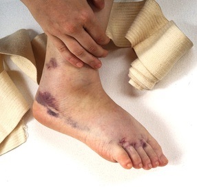 Ankle injury claims