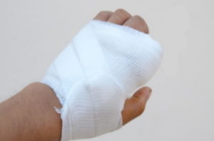 Broken hand injury
