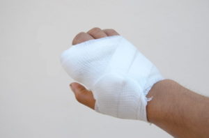 Broken knuckle accident at work