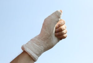 Broken thumb injury