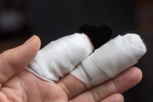 Partial finger amputation compensation