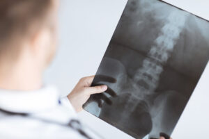 lumbar spine injury compensation