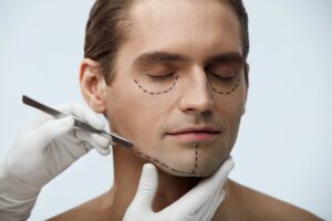 Plastic Surgery Negligence Claims