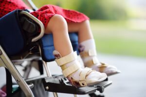 A child in a wheelchair with bandaged ankles and feet. 