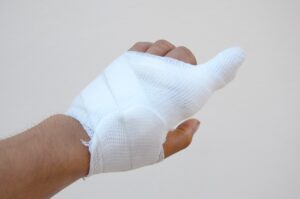 Finger Injuries