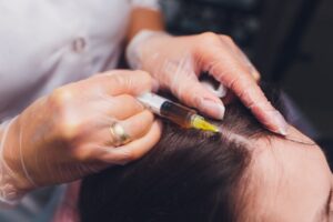 Hairdresser injury claims