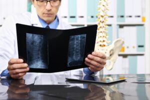 A doctor reading the results of an X-ray scan.