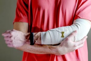 PERSON SUPPORTING BANDAGED ARM AFTER SUFFERING SOFT TISSUE INJURIES IN AN ACCIDENT AT WORK
