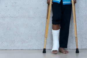 PERSON IN A CAST AND ON CRUTCHES AFTER SUFFERING AN ANKLE INJURY