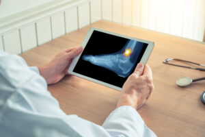 MEDICAL PROFESSIONAL LOOKING AT FRACTURED ANKLE ON A TABLET