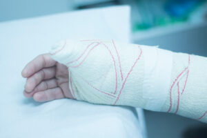 Person with arm in cast due to soft tissue injuries.