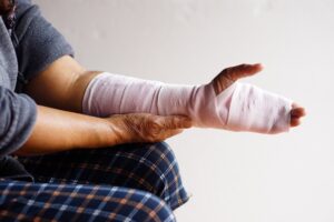 PERSON WITH BAD BURNS ON HAND AND ARM