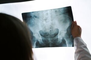 PROFESSIONAL LOOKING AT X-RAY TO AVOID MISDIAGNOSIS COMPENSATION CLAIMS