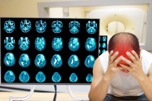 A man holds his head in his hands after an MRI scan of his brain.