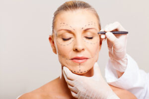 Woman preparing for cosmetic surgery on face with a medical professional 